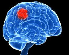 International Brain Tumour Awareness Week 2020 image